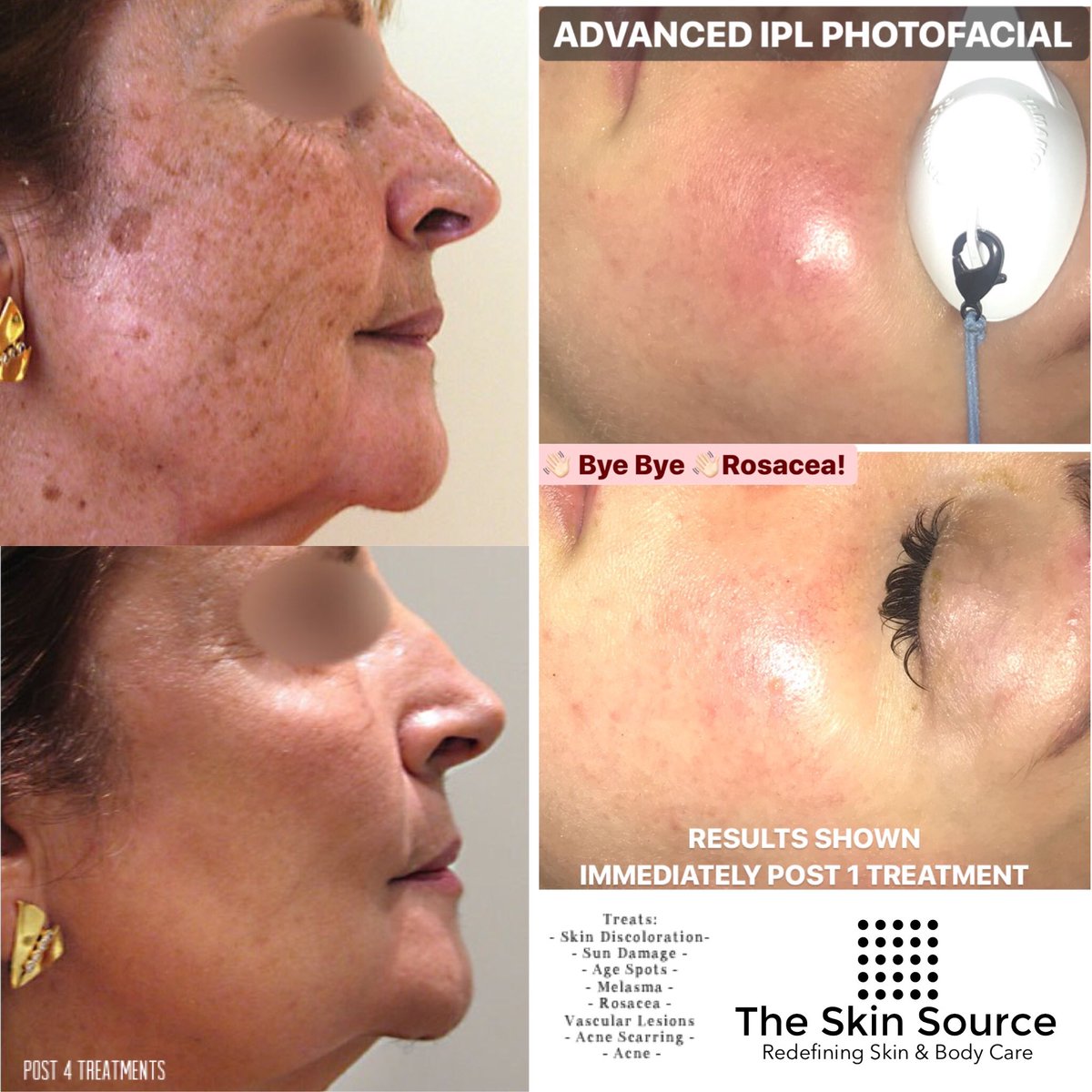TheSkinSource's tweet image. Book Now! 
(914)979-1721

MyOnlySkinSource.com