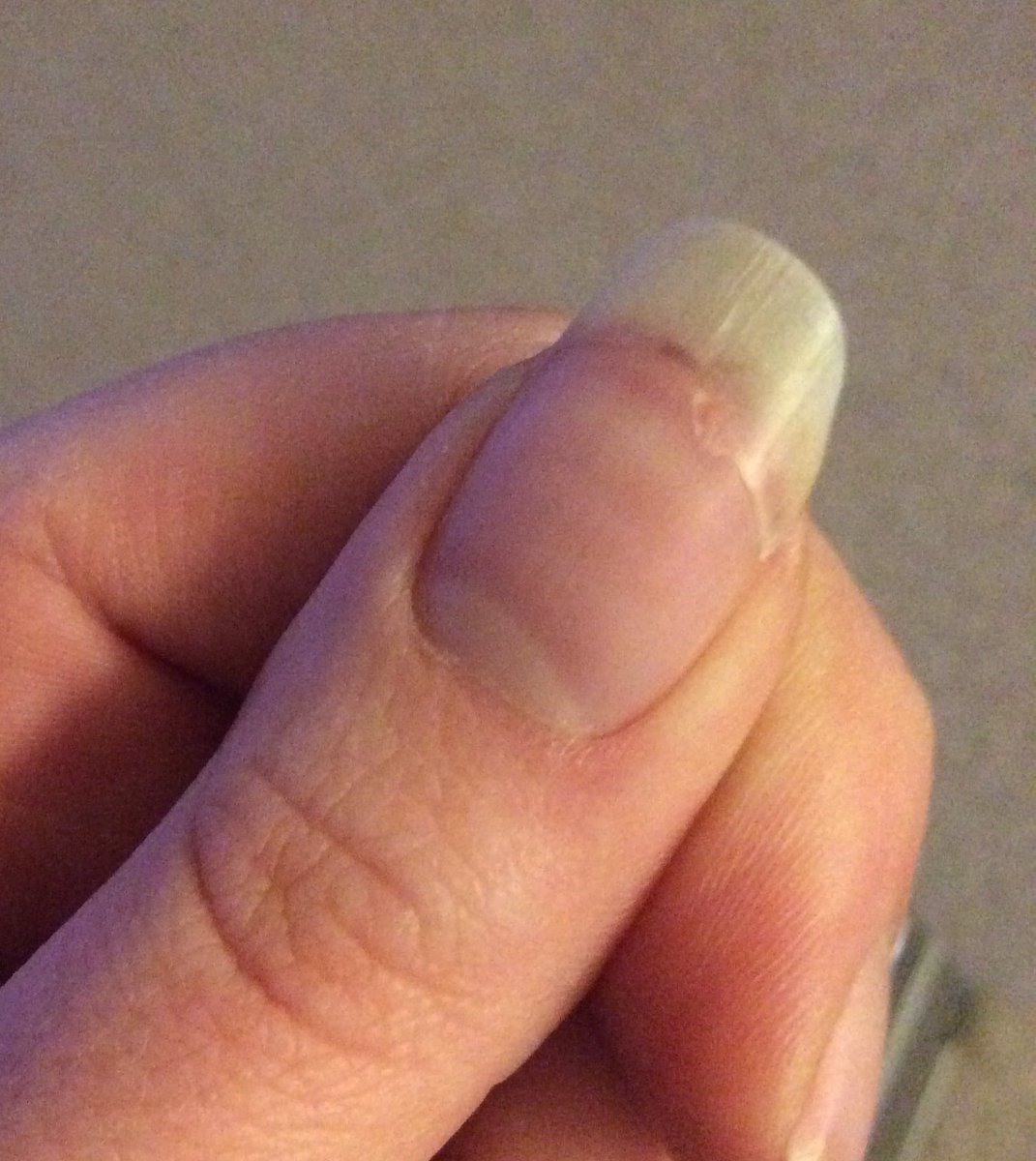 FrankstaPasta's tweet photo. @nailogical I should have listENED TO YOU 😭🤦🏻‍♀️ it hurt so bad. Not dirt - blood! 😭 https://t.co/KI5TWiTk8T