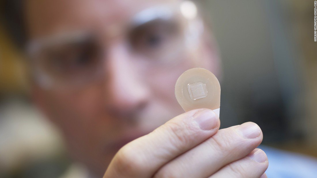 Breaking_News's tweet photo. Skin patch may be the future of flu vaccines https://t.co/6ySyrPp7m8 https://t.co/wbYQQFnSSo