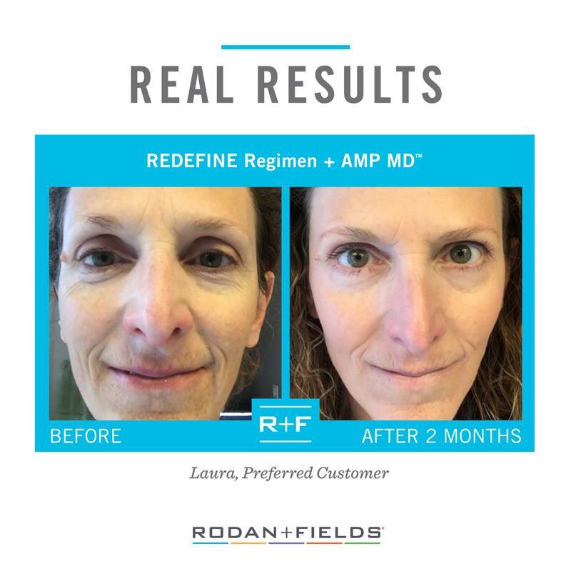 abkduran3's tweet image. Tune in this week as I introduce some of our top products! Today I will spotlight REDEFINE. 

Redefine is our regimen for the appearance of lines, pores, and loss of firmness. This regimen has peptide technology to help defend against and reduce the visible signs of aging. #R+F