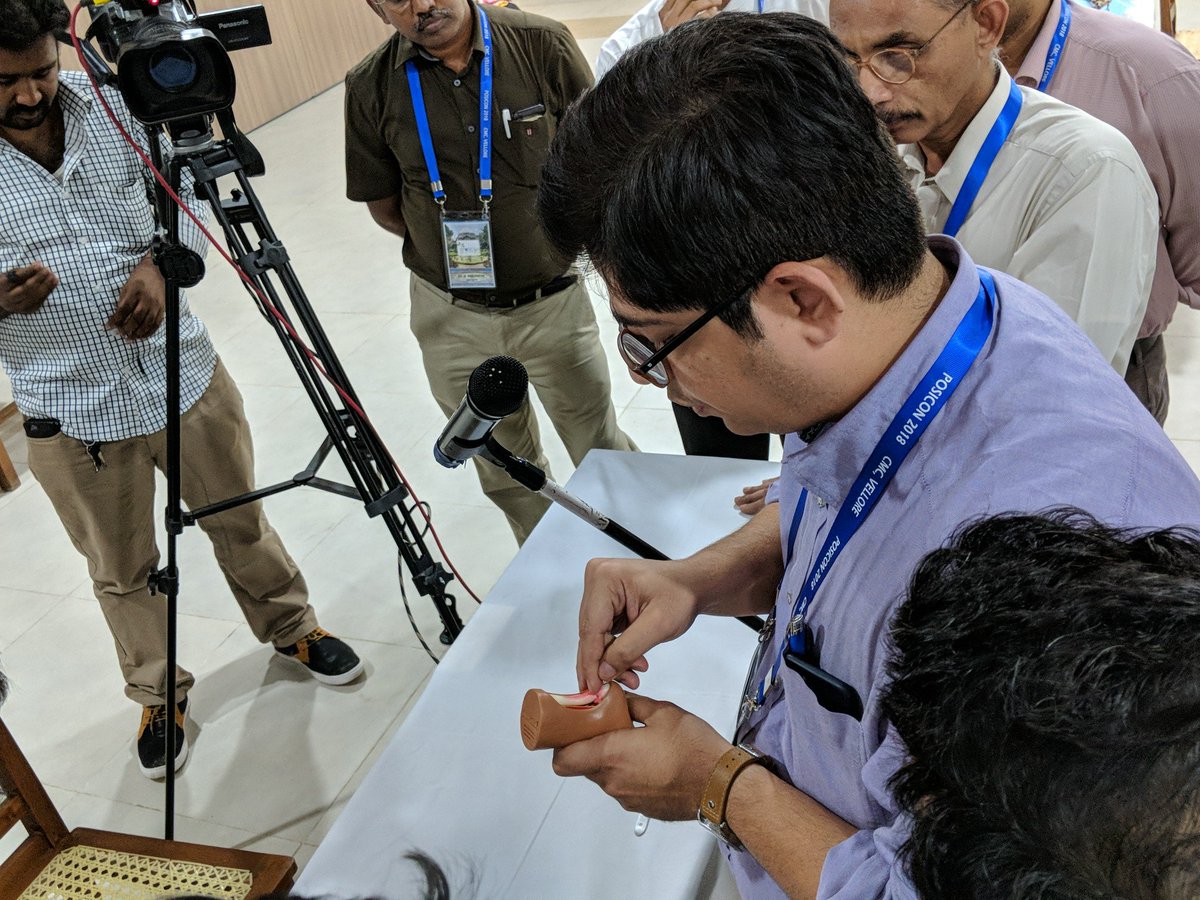 POSICONINDIA's tweet photo. Percutaneous tenotomy techniques by Dr. Rajiv Negandhi @POSICONINDIA https://t.co/SYuxboYC3d