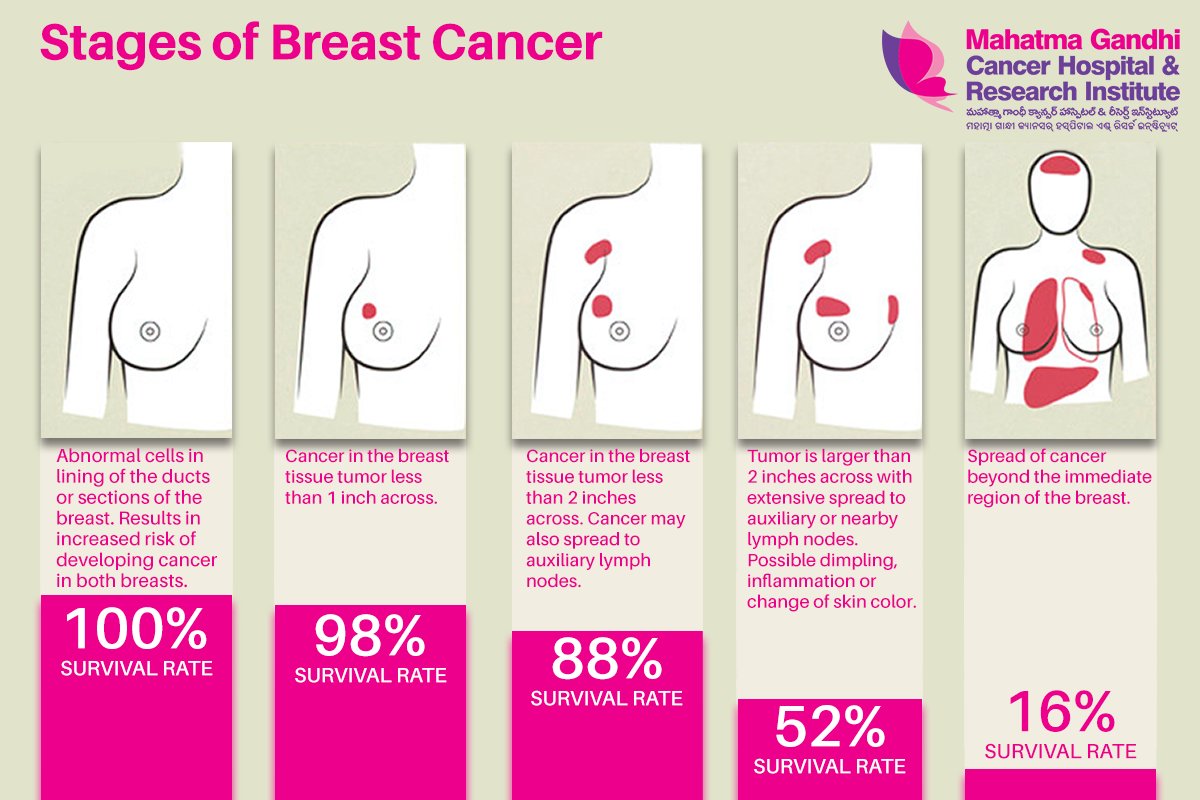 Symptoms And Complications To Understanding Breast Cancer Herxheimde