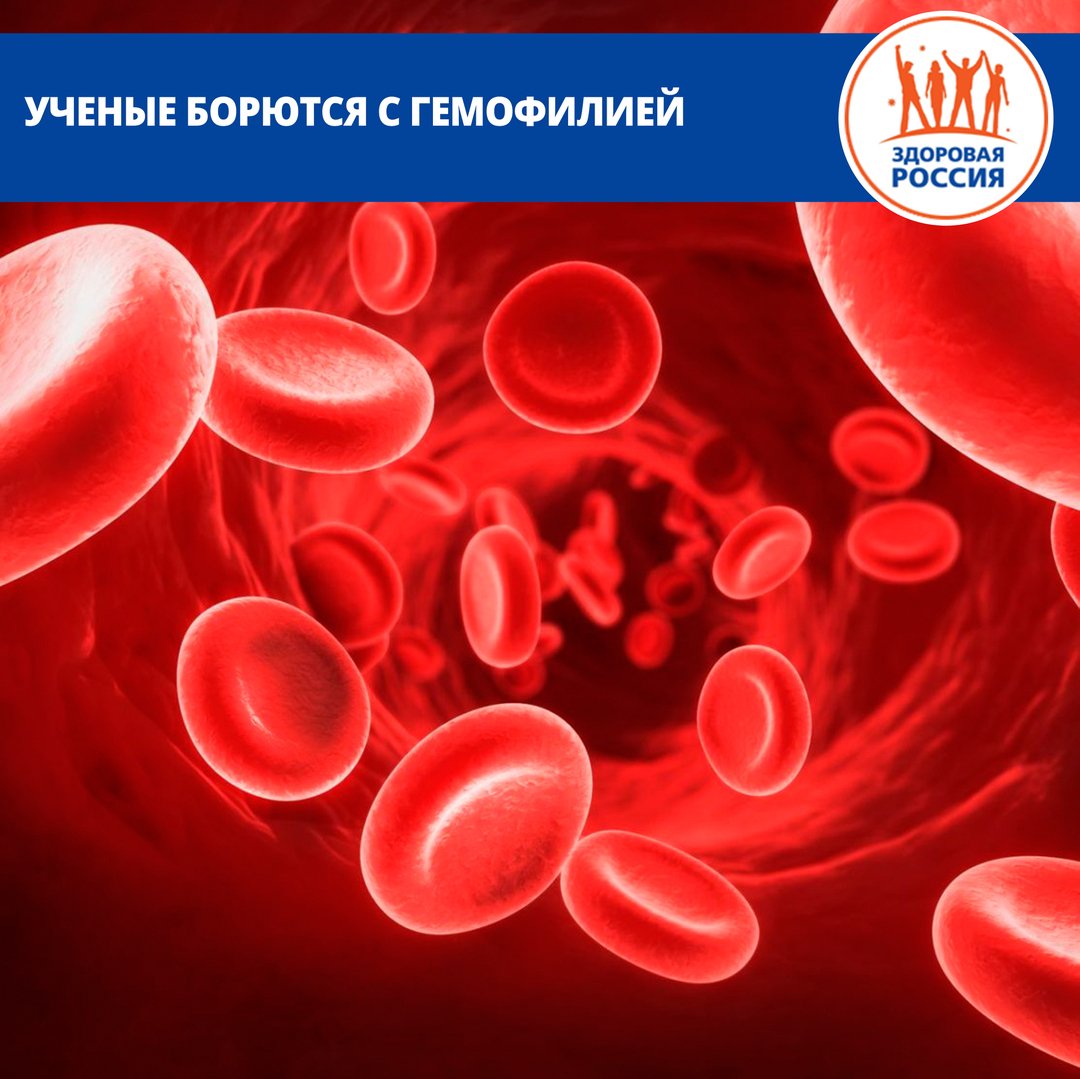 В Великобритании нашли способ борьбы с одним из самых опасных генетических заболеваний. Сотрудники Университета Королевы Марии создали препарат, который, по словам врачей, поможет вылечить гемофилию takzdorovo.ru/profilaktika/u… #такздорово #здоровыйобразжизни #ЯзаЗОЖ #зож