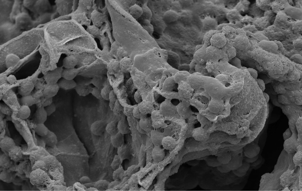 MolecularMatrix's tweet photo. Molecular Matrix, Inc. Receives a 510K Clearance for its Revolutionary #BoneGraft Substitute Technology, Osteo-P™! Read more here - https://t.co/uRlIsTfjOJ @UCDavisHealth​ #OsteoP #510k #HCCP #PolymerTechnology #BoneRegeneration #BoneVoidFiller #Orthopedics https://t.co/u4ytwB4wqJ