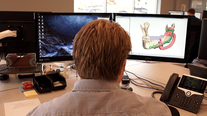 PeterCoffaro's tweet photo. 3D Systems and Stryker Team Up to Advance Personalized Surgery https://t.co/jeurHNvm3o @3dsystems #3dmodels #3dprinting #CMF #CustomGuides #partnerships #patientspecific #PersonalizedMedicine #simulation #Stryker #SurgicalPlanning https://t.co/zU9Oo0dB75