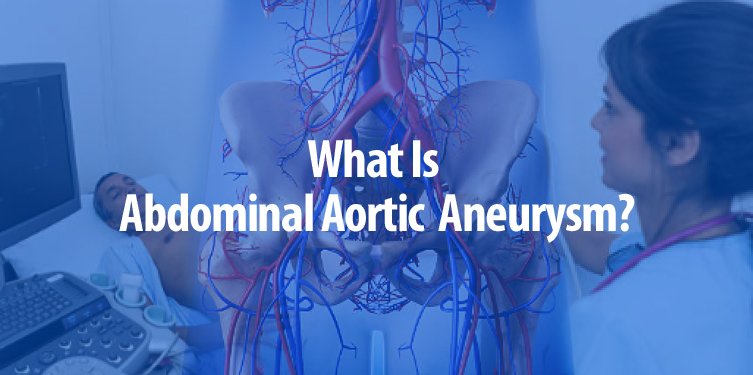 mvsdoctors's tweet photo. As noted by the Society of Vascular Surgeons, 200,000 people in the U.S. are diagnosed with an abdominal aortic aneurysm #AAA each year.

Blog - https://t.co/3OidcUEMop

#dyslipidemia #CVD #symptoms #aortic #Rheumatology #GCA #ACR2013 #Valve #surgery #Aneurysm #stenos https://t.co/sjuxexzXSq