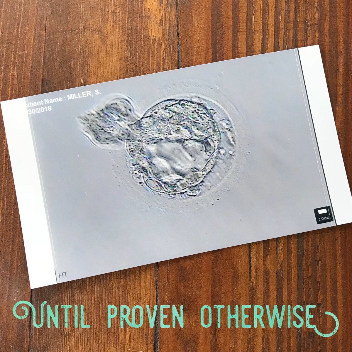 makingamiller's tweet photo. Pregnant! Until proven otherwise. Blogging about my transfer day and how I’m feeling now:
https://t.co/1R8GDEbBAf
#IVF #fet #ivfstrongertogether #infertility #ICSI #ivfwarrior #MakingAMiller https://t.co/tz1TA5SLpl