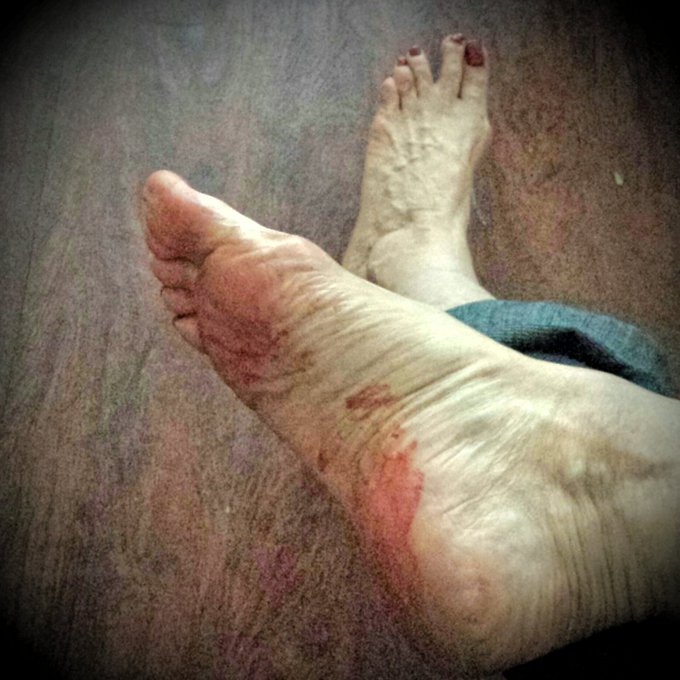 #CBT #Femdom #Footfetish #bdsm sessions all day today.  I will crush your little grapes.  You will learn<a href="/tag/cbt"class="tags">#CBT</a><a href="/tag/femdom"class="tags">#Femdom</a><a href="/tag/footfetish"class="tags">#Footfetish</a><a href="/tag/bdsm"class="tags">#bdsm</a><a href="/tag/mommydiscipline"class="tags"><span>#mommydiscipline</span></a>