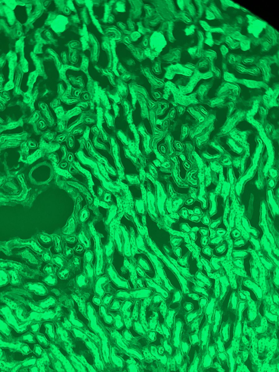 carney_lab's tweet image. Fully 3D printed adapter for coupling a smart phone camera to any microscope eyepiece! So much fun to use in the lab... @lulzbot3D @UCDavisResearch