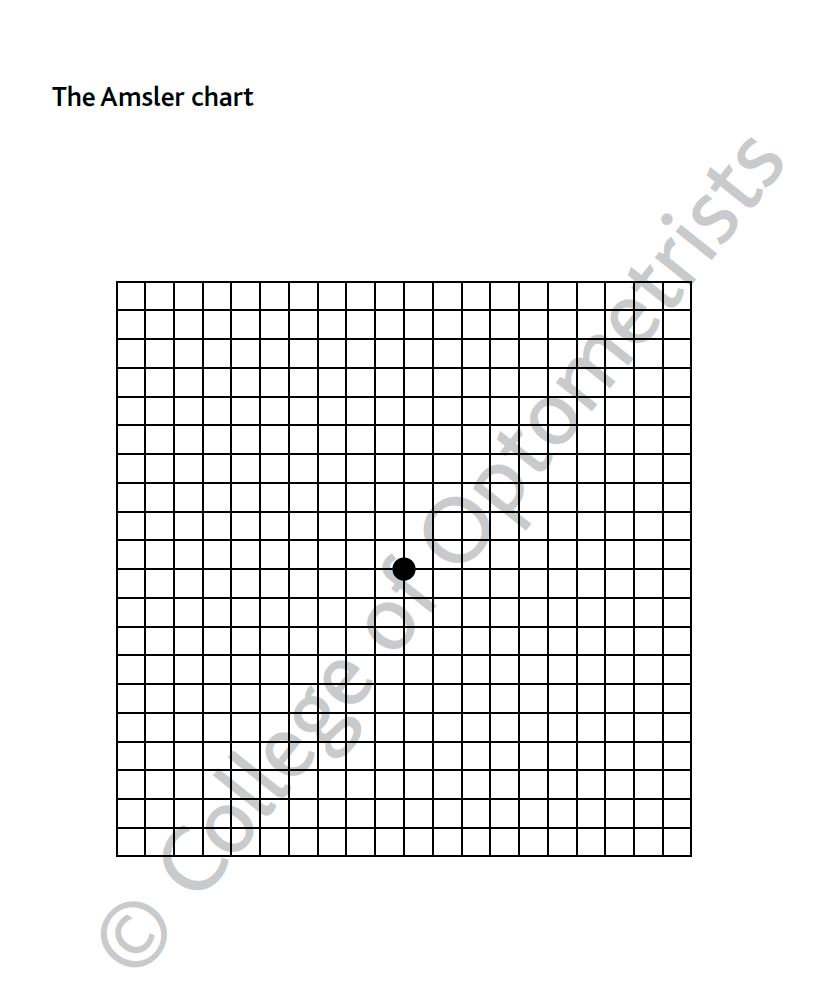 Amsler Chart Working Distance