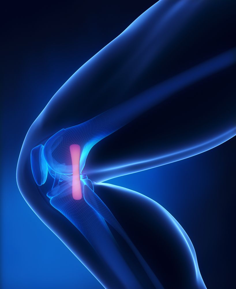 drprovencher's tweet photo. Even though patients are more familiar with an #ACLinjury, #MCLinjuries account for approximately 24% of all knee injuries. https://t.co/DD5ven27CB https://t.co/GD1YQUsBDw