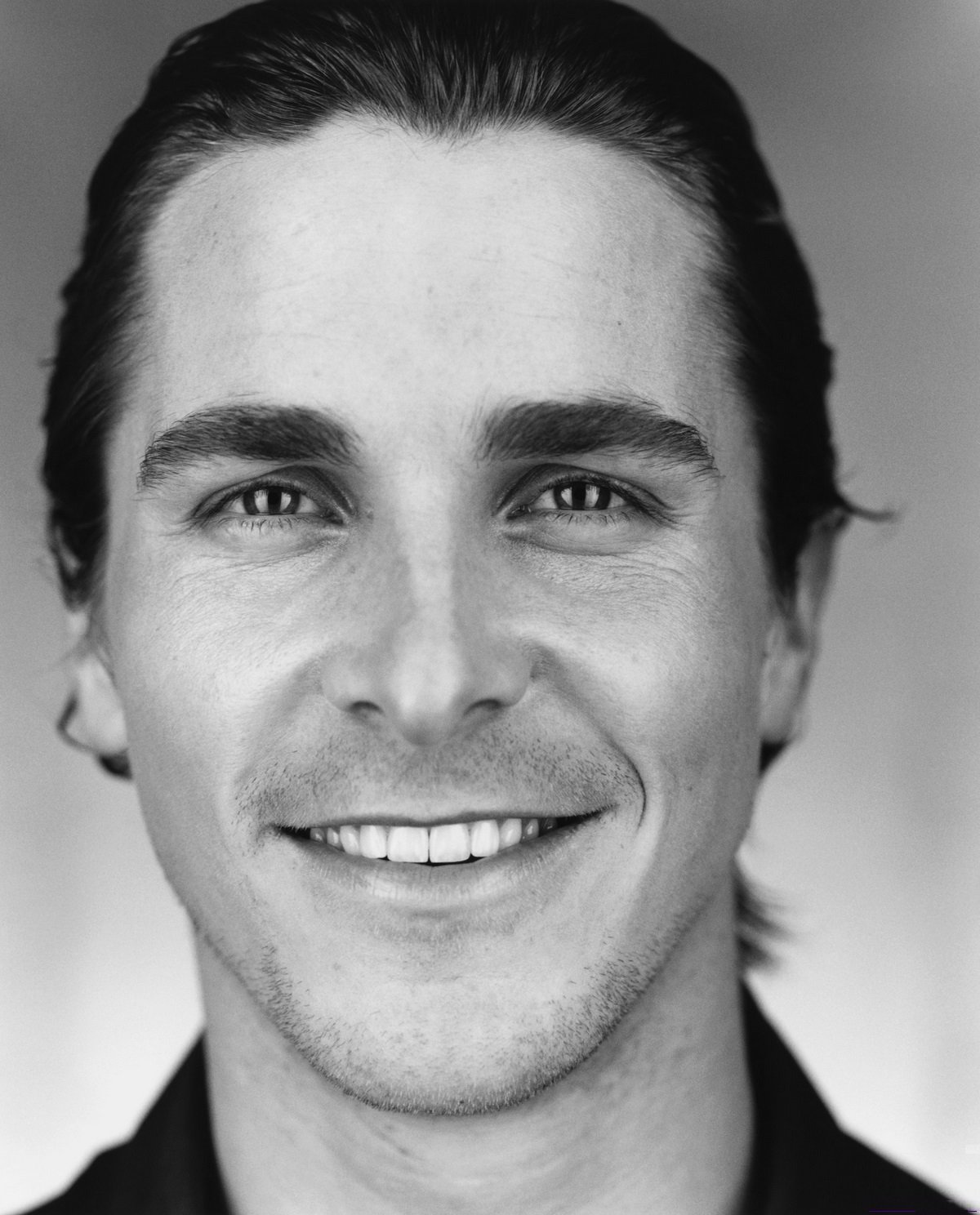 Christian bale teeth before and after