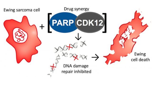 crownbioscience's tweet photo. #Drug Target for #EwingSarcoma Identified - #CDK 12, potential for combination with #PARPinhibitor https://t.co/OWw8chtHzP #cancerresearch #PARP #PARPi @BostonChildrens @Tech_Networks https://t.co/L2Pc3pfCjU
