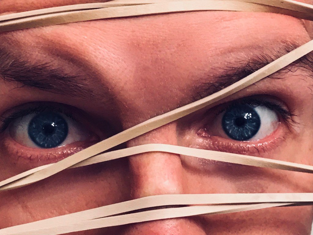 DoctorRichey's tweet photo. Are You a Rubber-band Pathologist?The Rubber-Band Pathologist and How to Avoid Becoming One https://t.co/nxLgoOqbtH https://t.co/BdtGscKCHR