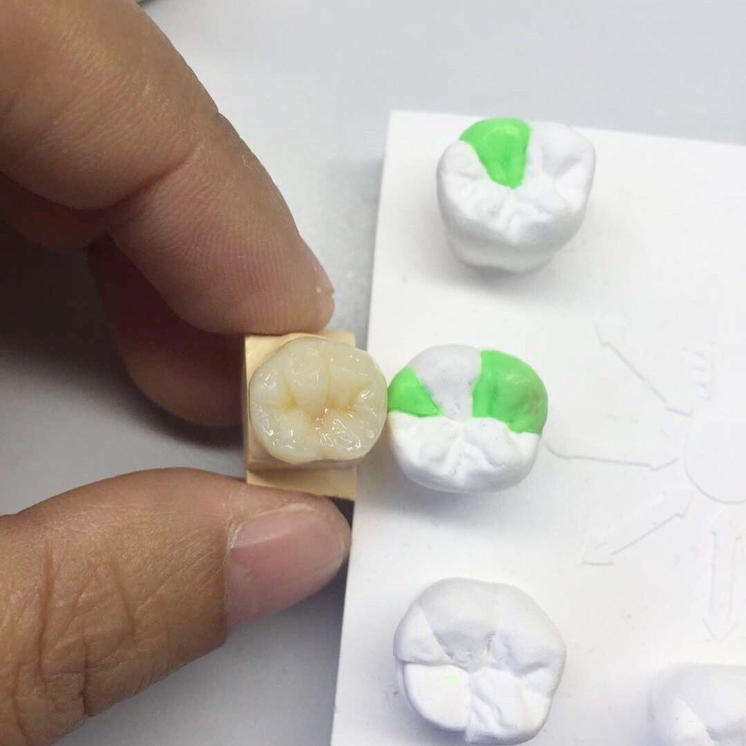 TOP_dentallab's tweet photo. Hello, February! 😄😄👋👋#topdental #dentallaboratory #dentallab #topdentallab #crown #ceramic #feburary #dailycase #teeth #fabrication #dentaltechnician #denture #dentistry #dentalworld #dentalwork https://t.co/LE0i2Za0zj