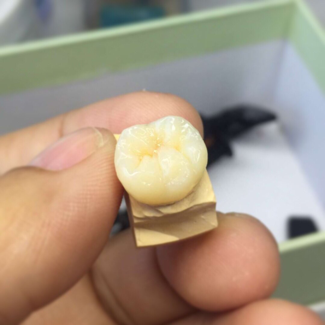 TOP_dentallab's tweet photo. Hello, February! 😄😄👋👋#topdental #dentallaboratory #dentallab #topdentallab #crown #ceramic #feburary #dailycase #teeth #fabrication #dentaltechnician #denture #dentistry #dentalworld #dentalwork https://t.co/LE0i2Za0zj