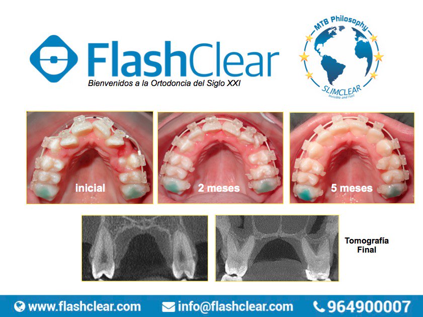 FlashClearSys tweet picture