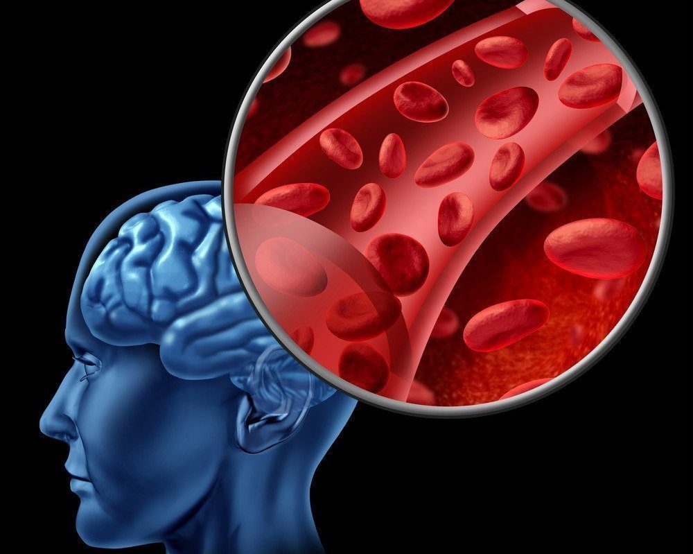 ZavalishinEE's tweet image. Сосудистые аномалии и атеросклероз экстракраниальных сосудов
dr-zavalishin.ru/statii/sosudis…

#нейрохирургия #клиниканейрохирургиивмоскве #нейрохирургиявмоскве #нейрохирургиянабабушкинской #остеохондроз #консультациянейрохирурга #лучшийнейрохирургМосквы #нейрохирургиянабабушкинской