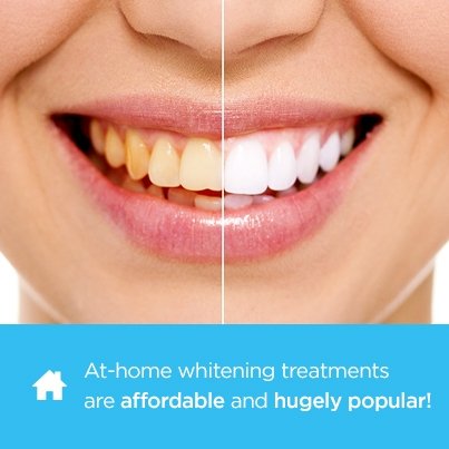 toothtweetenDDS's tweet photo. At-home whitening treatments are affordable and hugely popular. Which have you tried and what'd you think? https://t.co/gFylwkK9Oi