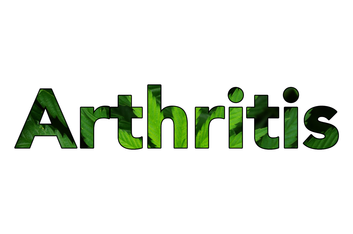 BodystreamMed's tweet photo. "more than 50 percent of people who use #MedicalCannabis did it to alleviate #arthritis pain." Janet Yale, president and CEO of the Arthritis Society
https://t.co/3BRubigML0 …
#BodystreamMedical #MarijuanaClinic #CannabisClinic #MedicalMarijuana #Marijuana #MedicalMarijuana https://t.co/FUBdE0Ecig