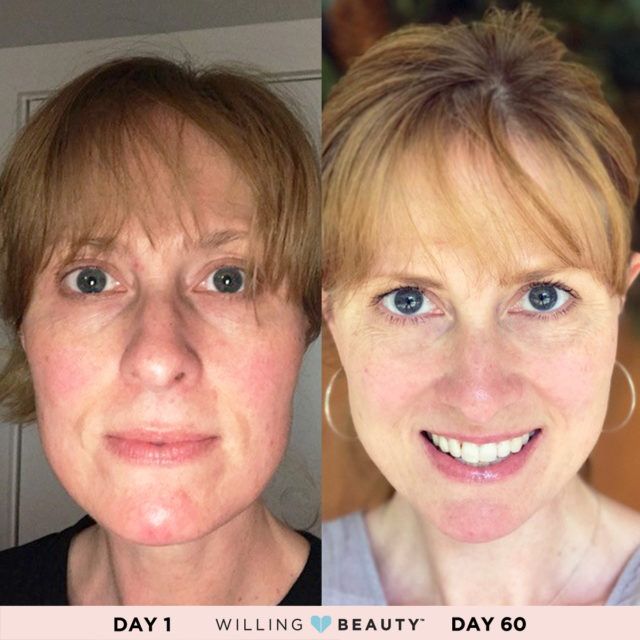InspiredBeauty6's tweet photo. There are so many benefits to using Natural Skincare. Do you want to Look & Feel Your BEST everyday? Msg Me for more. #treatyourself #youdeserveit #loveyourskin #lookandfeelyounger #womensupportingwomen #girlboss #workfromanywhere #softsmoothskin #inspiredbeauty #beautifulskin https://t.co/rufDJgxtxn