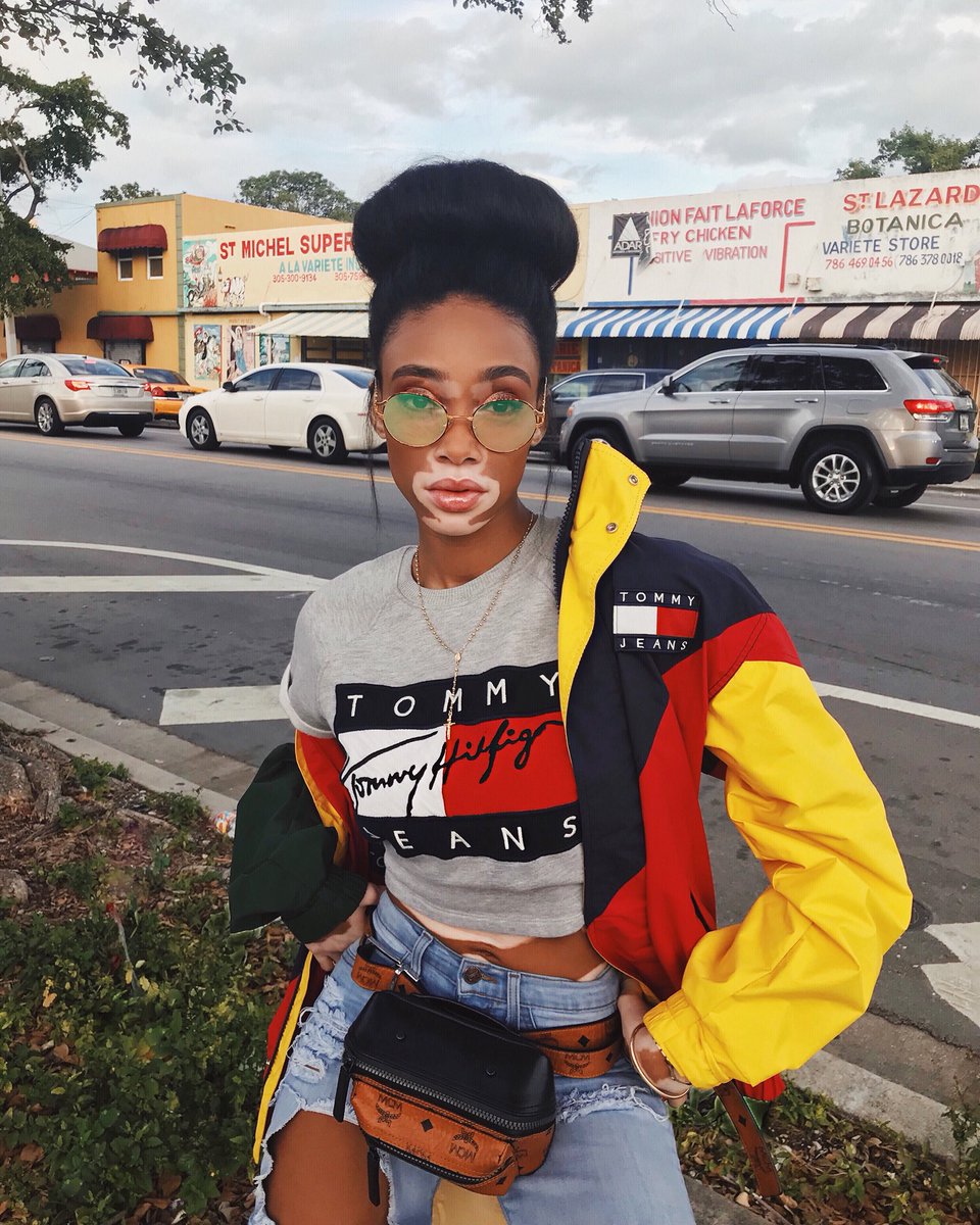 winnie harlow tommy hilfiger