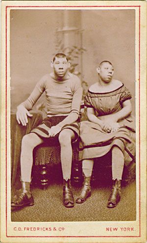 19. Explorers who found Tom & Hattie in 1911 thought they were kangaroos.They referred to them as being "sharp-toothed cannibals" belonging to a "distinct race hitherto unknown to civilisation.”However, they were simply severely mentally disabled siblings from Circleville, Ohio