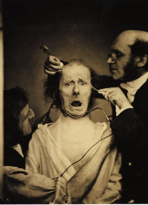 3. To study facial muscles, Neurologist Duchenne de Boulogne electrocuted a man’s face in 1862.Medical ethics have come a long way since then.