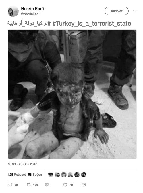 doganburak29's tweet photo. Bu yaralı çocuk fotoğrafını servis eden PKK hesaplarına inanmayın.

2016 yılında Halep'te yaşanılan saldırıdan çekilen fotoğraftır. https://t.co/m2jTzCgyUC