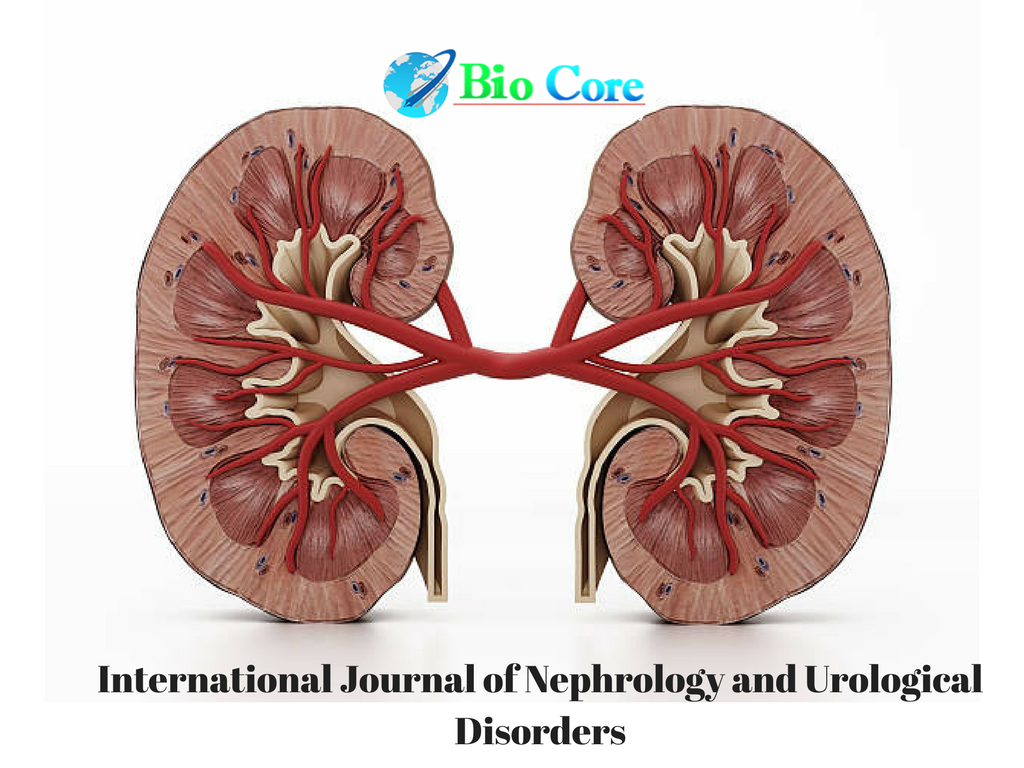 Biocore_Ijnu's tweet photo. See how an open access publication will allow your research to reach maximum people.https://t.co/M8aYbK1IAG
#Biocore_Group
#Biocore_Open_Access_Journals
#IJNU
#Nephrology_Journal
https://t.co/v8VLIMyLTZ https://t.co/3g1YMLi5bk