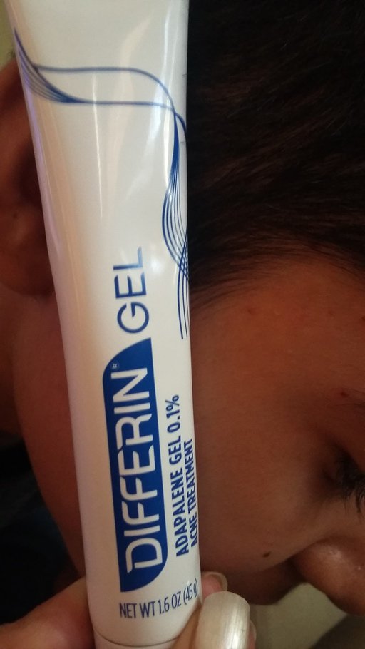 Jessica95603736's tweet photo. #ad Clear acne, prevent breakouts to restore skin with everyday #DifferinGel. Available without a prescription! #ad https://t.co/GQoApZK28Z