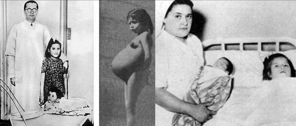 29. In 1939 Peru, Lina Medina gave birth.She is the youngest mother in medical history to give birth at the age of 5 years, 7 months & 17 days.She started her period at 8 months & grew breasts from age 4.She is still alive today, aged 84.The baby's father was never identified