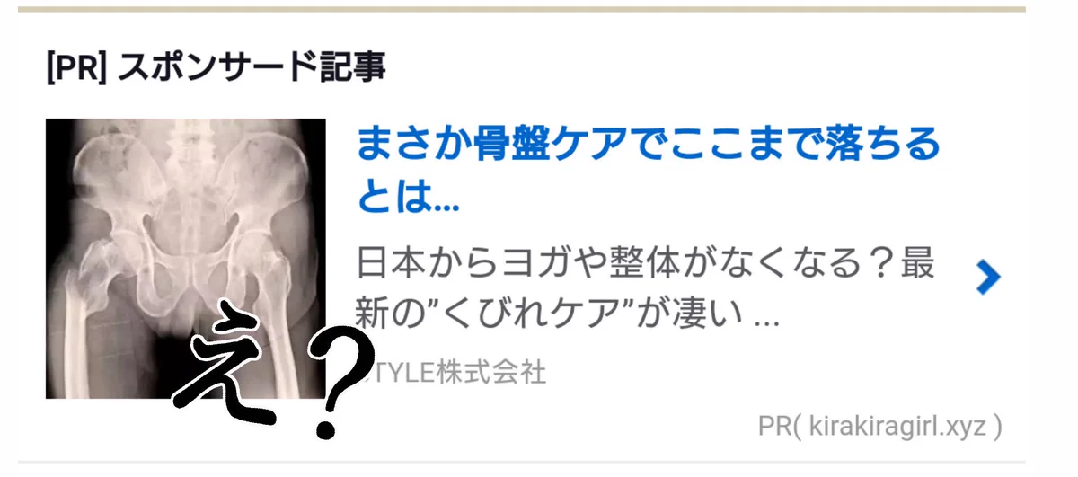 写真適当すぎだろｗｗｗ骨盤ケアの前に右の大腿骨折れてるｗｗｗ