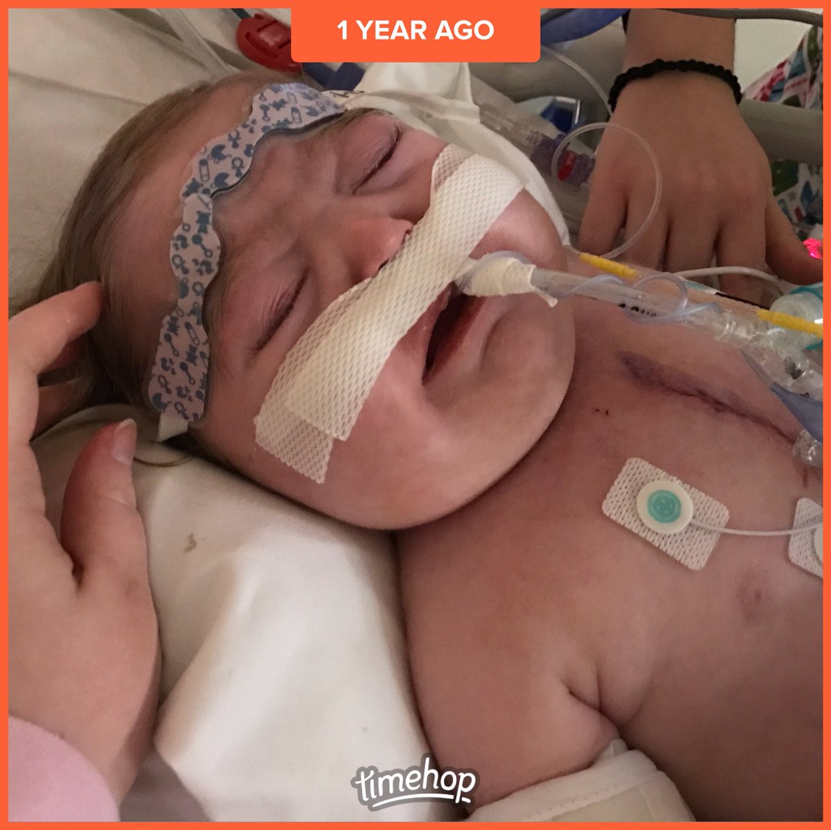 back_in_thyme's tweet photo. #miraclebaby #givethegiftoflife #1in100 #chdawareness #hlhsawareness #intactatrialseptumawareness #pulmonaryhypertensionawareness #pulmonaryveinstenosisawareness #hearttransplantawareness #ardsawareness #childhoodillness https://t.co/pk5Rs38VhV