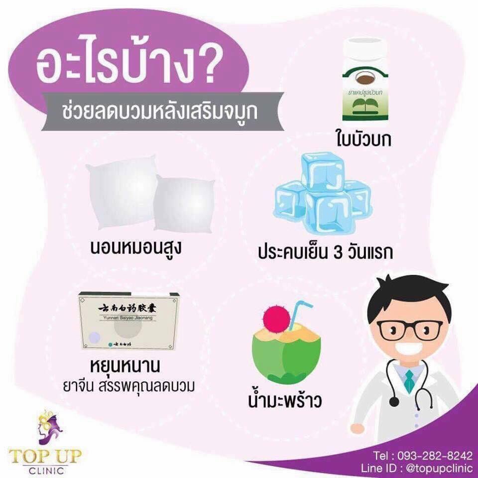 ยาลดบวม reparil