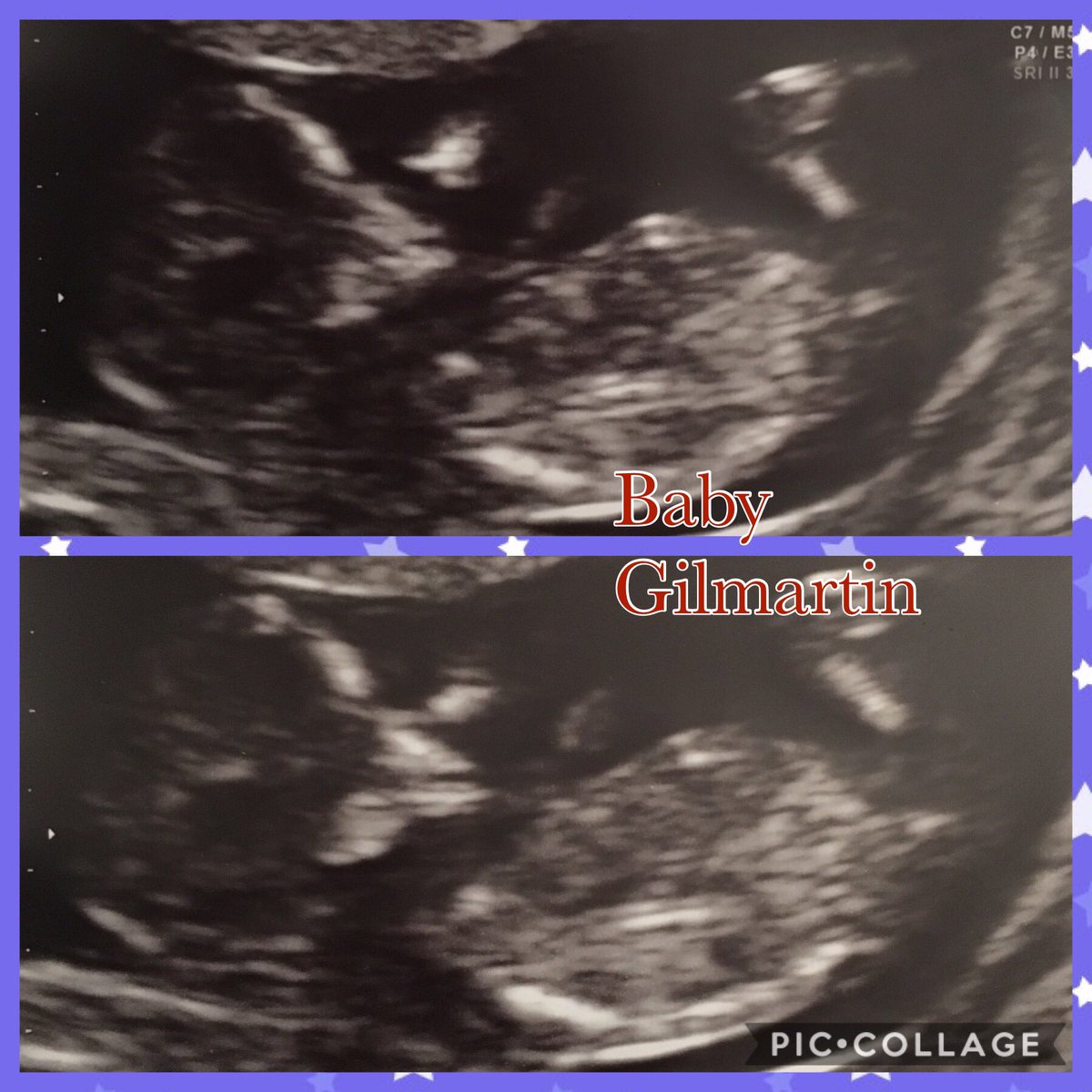KK14REN's tweet photo. That’s our little baby 👶🏼💖💙 #love #baby #2mummies https://t.co/PmIqW9fibh