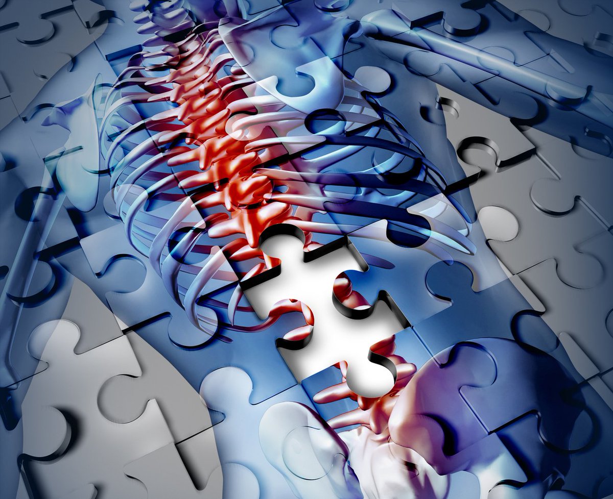 TheOrthoGuru's tweet photo. 19 #Spine and #Orthopedic #MedicalDevice Companies to Watch in 2018 https://t.co/znPy5PC7iX https://t.co/vKDDAaqZak