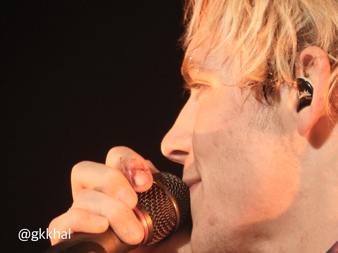 DailyRoss's tweet photo. [PHOTO] "すっごい痛そうなのにギター弾くのやめないし本当にファンのこと考えてくれてる。
.
撮ってる時は気づかなかったけど家帰って来た時確認してたら泣きそうになった" (via gkkhal on Instagram) https://t.co/QYWoSZ8Gid