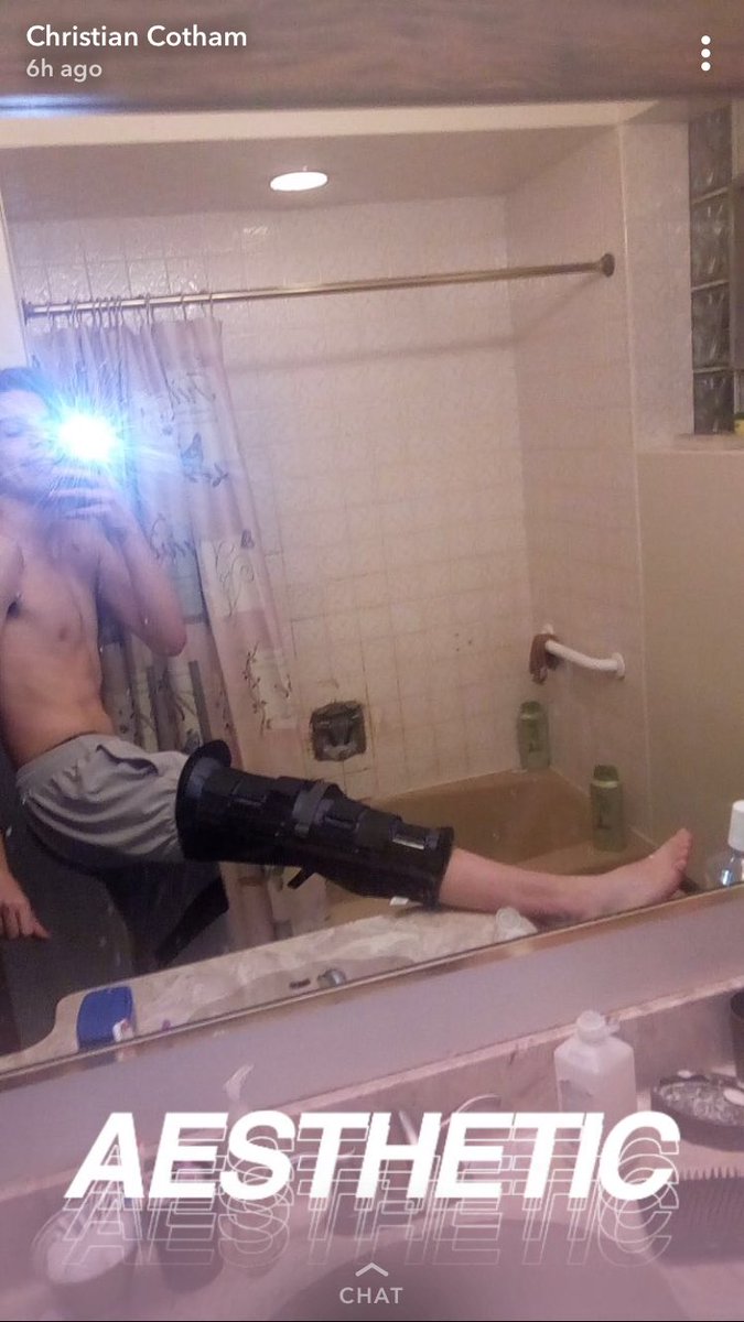 IanVranek's tweet photo. St Louise Jr. leading scorer, Christian Cotham in a leg brace (pictured below) after suffering gruesome injury in practice. Out 1-2 weeks and is listed as questionable for next week's road game @ St Johns. #Churchleague #Stillwinless #Byeweek  @Church_League https://t.co/NLFyIQdF4D