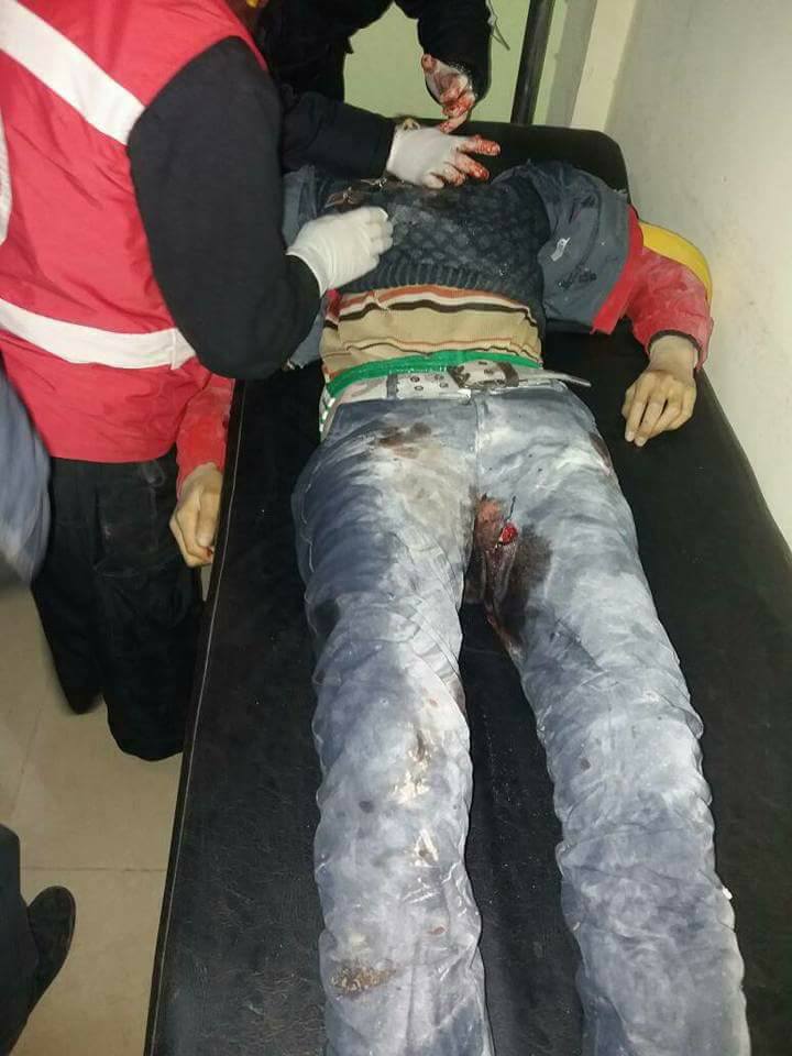 KMM2013ROJAVA's tweet photo. ضحايا القصف التركي على جنديرس السورية من المدنيين أغلبهم أطفال . https://t.co/abxuG057V3