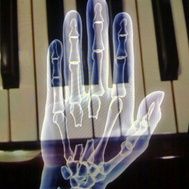 Renault5-TklasII tweet media