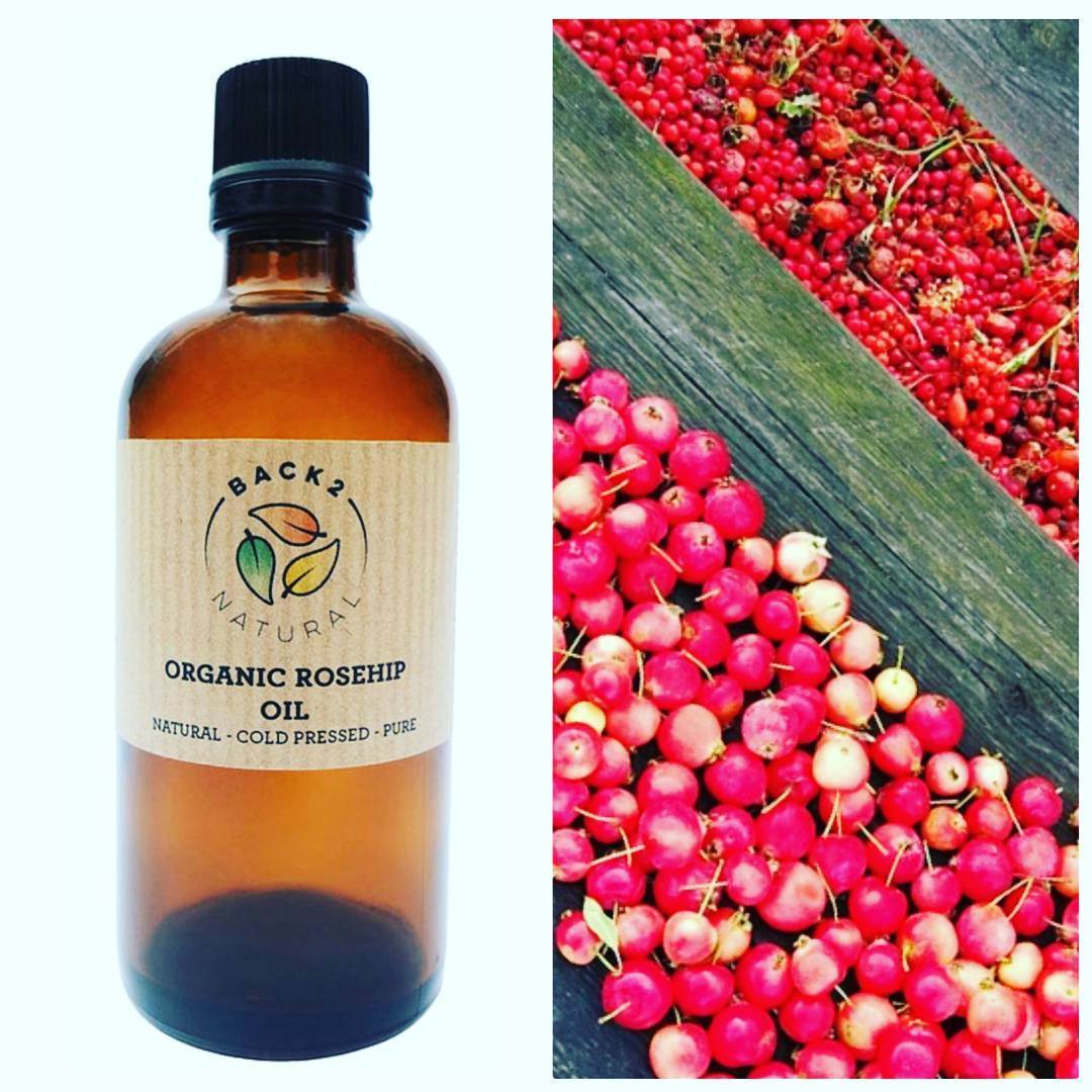 Back2NaturalUK's tweet image. Rosehip Oil is one of our best selling products, extracted from the seeds of a wild bush rose. It can help repair skin &amp;amp; give all over nourishment for optimum skin health, commonly used to treat &amp;amp; smooth scars, stretch marks, fine lines, wrinkles &amp;amp; various other skin conditions.