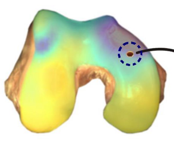Biomomentum's tweet photo. #CaseStudy: Sequence of #MechanicalTests for #Articular #Cartilage at a single location https://t.co/hYBnwkK3QY The importance of considering the natural topographic variability of the mechanical properties of cartilage over the articular surface, particularly in cartilage repair https://t.co/HBze28vmQC