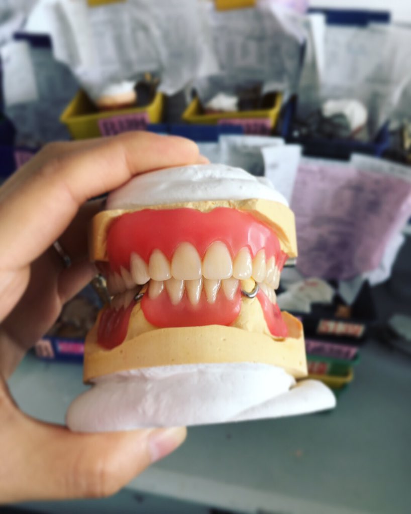 TOP_dentallab's tweet photo. Waiting to be finished 😜#topdental #topdentallab #outsourcing #waxup #dental #dentistry #fullmouth #acrylic #teeth #dentallab #setup #tryin #falseteeth #madeinchina #dailycase #smile #removables https://t.co/UsEWJ0J0su