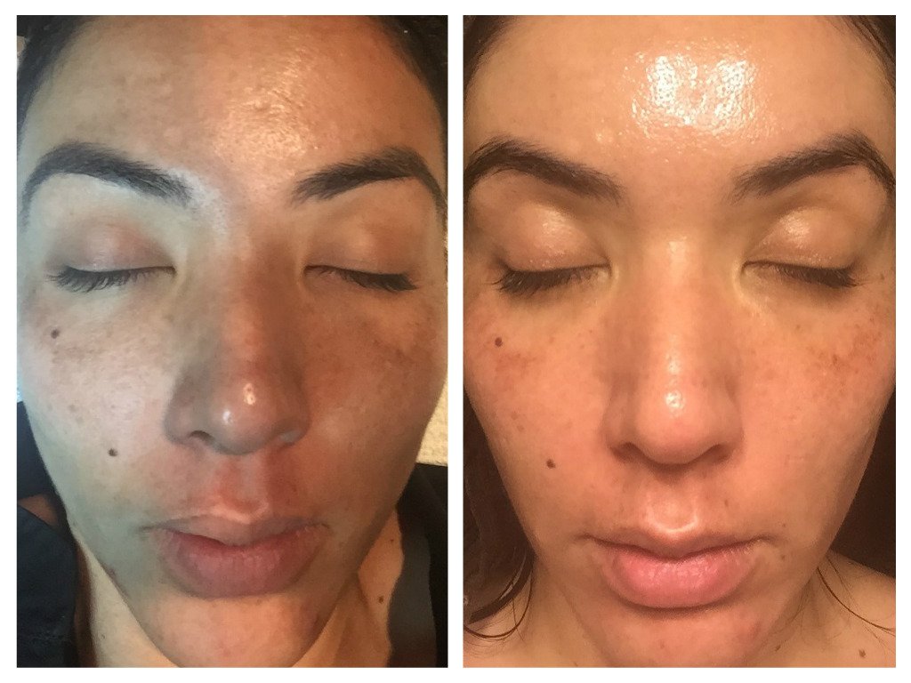 ThePerfectDerma's tweet image. It's a new year!  
Step up your skin care routine with a PERFECT DERMA PEEL.
See younger looking, clearer and brighter skin in about a week.