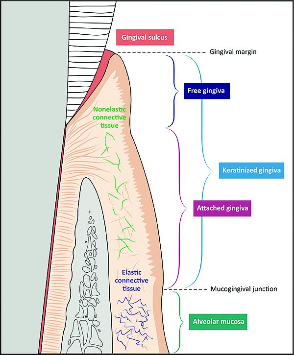 implant placement according to future cerec restoration and biological width dentaltown message board implantology