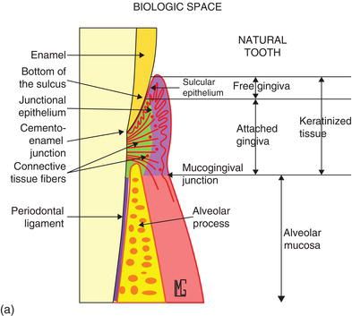 implant placement according to future cerec restoration and biological width dentaltown message board implantology