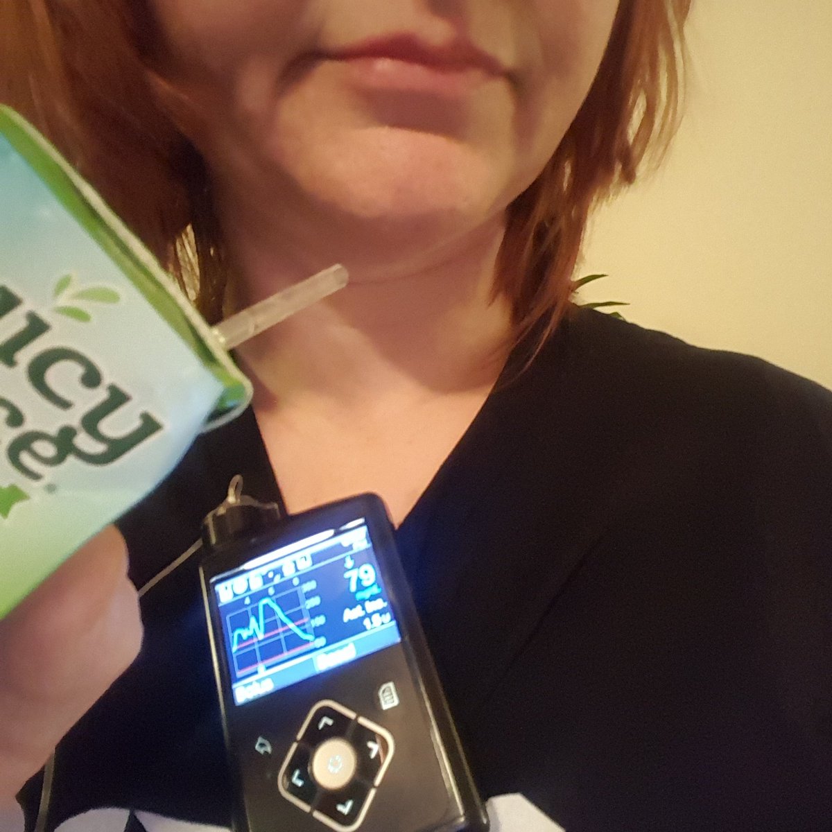 When you have to delay your workout so a juice box can save your life! #juicyjuice #juiceboxmafia #t1dproblems #cgm #cgms #Medtronic #t1dwontstopme #t1dyoudontsee #T1DLooksLikeMe