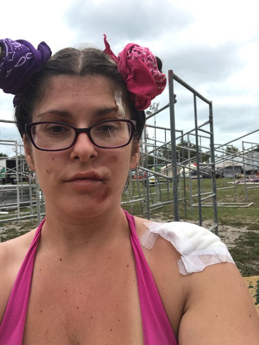 Of course I fucked myself up while camping. Tripped over an unlit cord cover on my way to get ready for<a href="/tag/lovense"class="tags"><span>#lovense</span></a>
