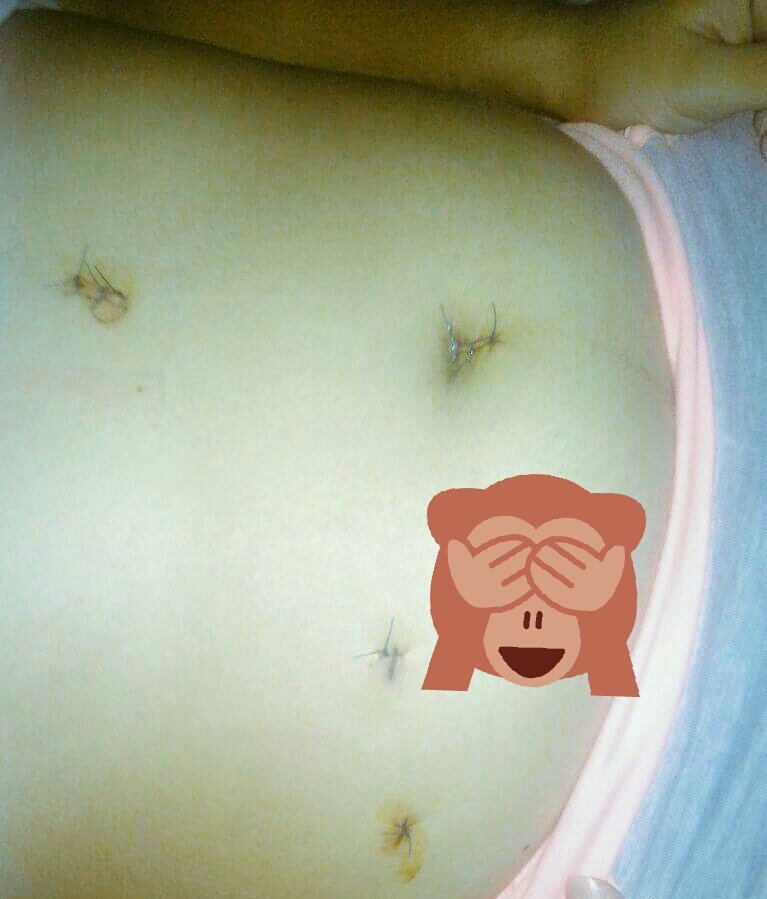 __Aleja25's tweet photo. Sanando las heridas😩😩 con la ayuda de Dios🙏💖 https://t.co/cwPYma9thP
